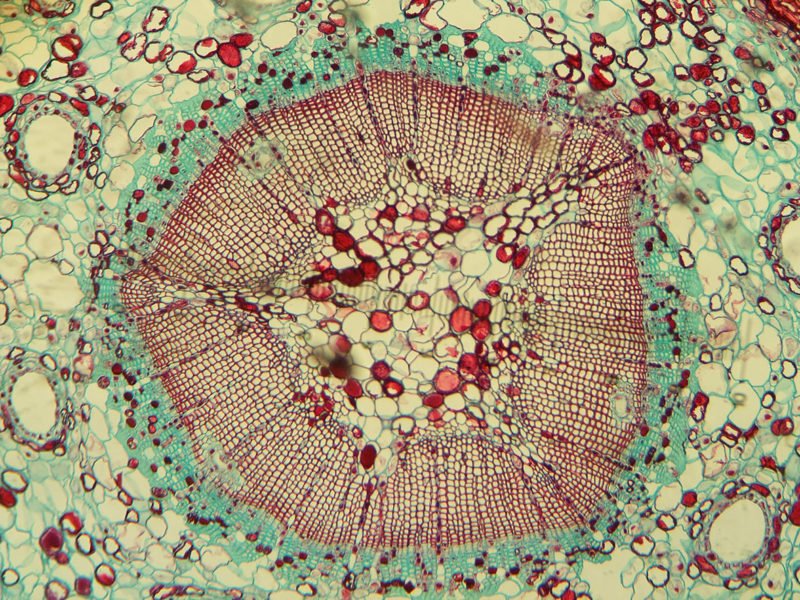 Microscopic image of a plant cell